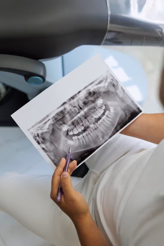 Person hält eine Zahn-Röntgenaufnahme und zeigt mit einem Stift auf einen Bereich im Unterkiefer.