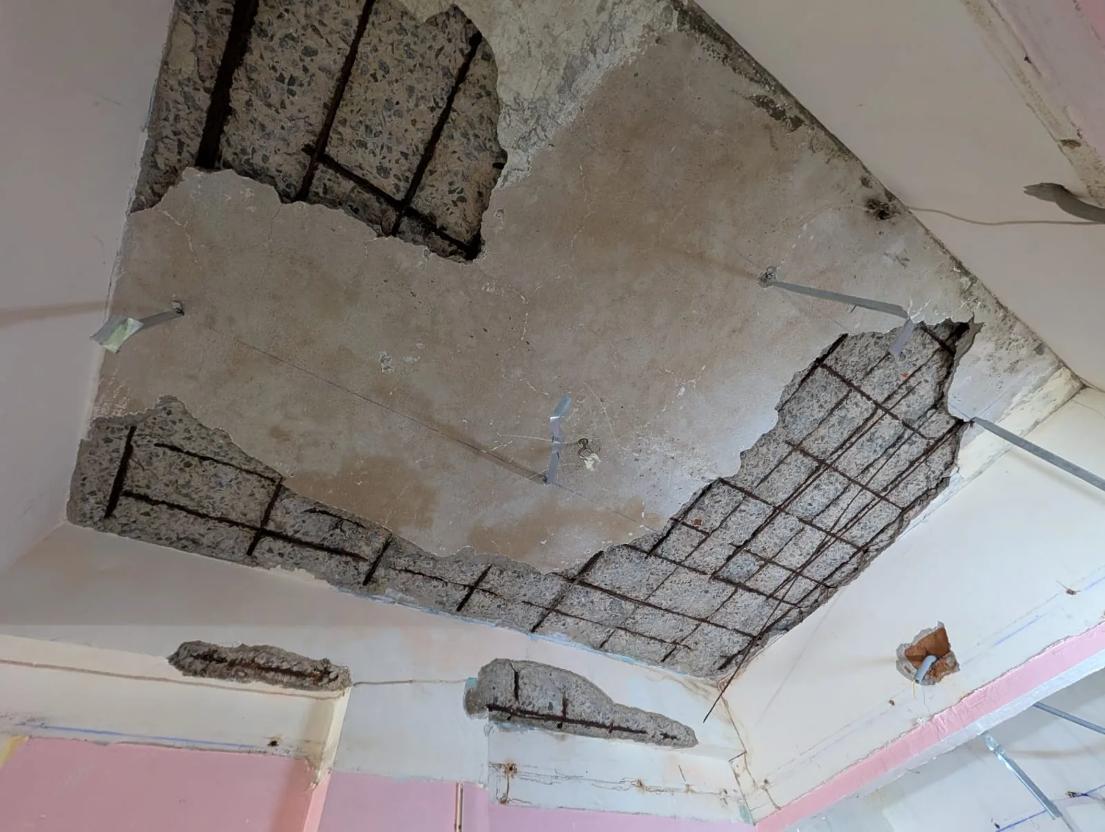 Severe concrete spalling with exposed corroded reinforcement — 35-year-old residential building structural inspection Chennai