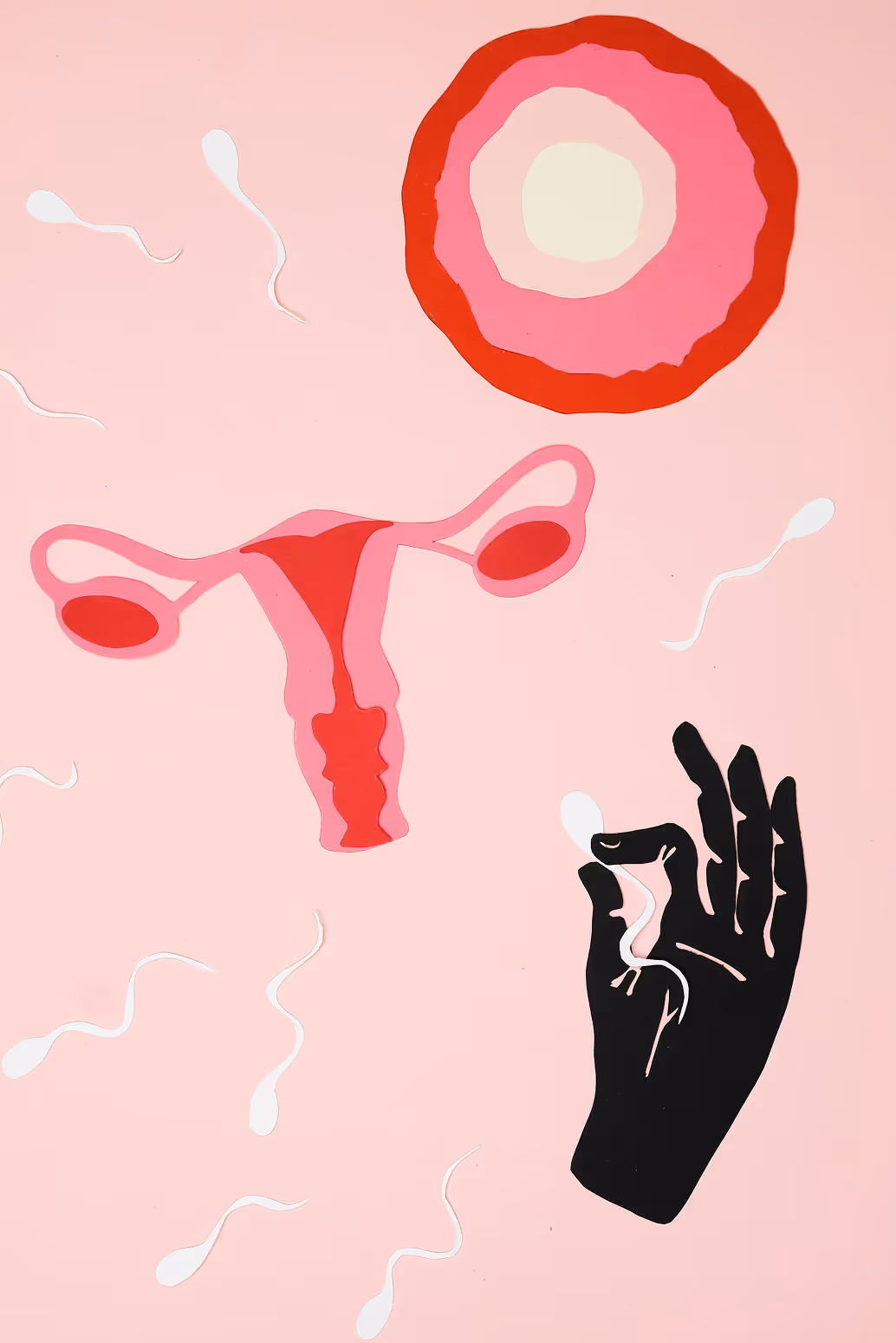Medical illustration of the female reproductive system with sperm cells representing the process of fertilization.