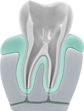 Ilustrace průřezu zubu s korunkou, dásní a zubní dření v detailu.