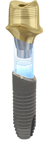 Zubní implantát s šroubovatelnou zlatou nástavbou a průhlednou částí ukazující vnitřní konstrukci.