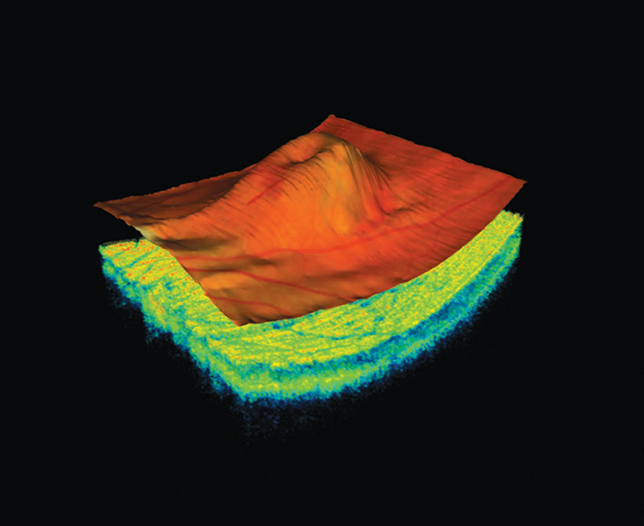 Advanced 3D retinal scan showing detailed view of eye tissue layers for detecting conditions like glaucoma and macular degeneration