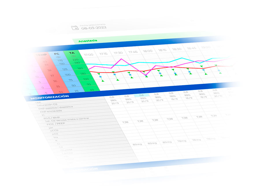 Extend Webflow with Attributes by Finsweet