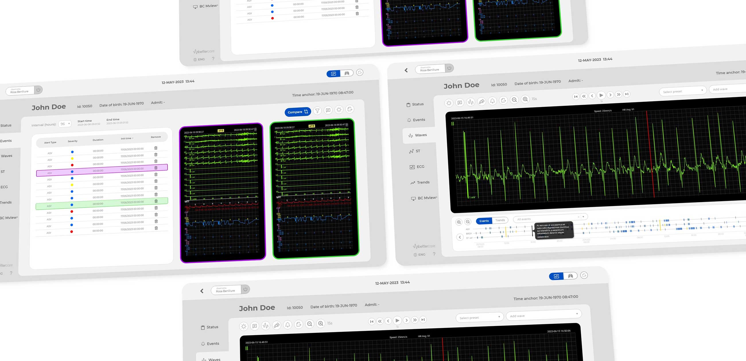 Pantalla de software médico mostrando gráficos de ritmo cardíaco y tabla de eventos para paciente John Doe.