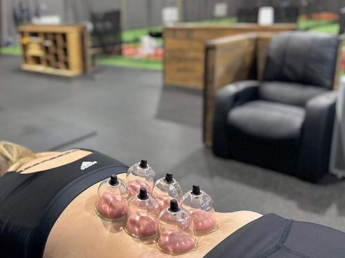 Six clear suction cups applied to a person's bare back during a cupping therapy session in a gym setting.