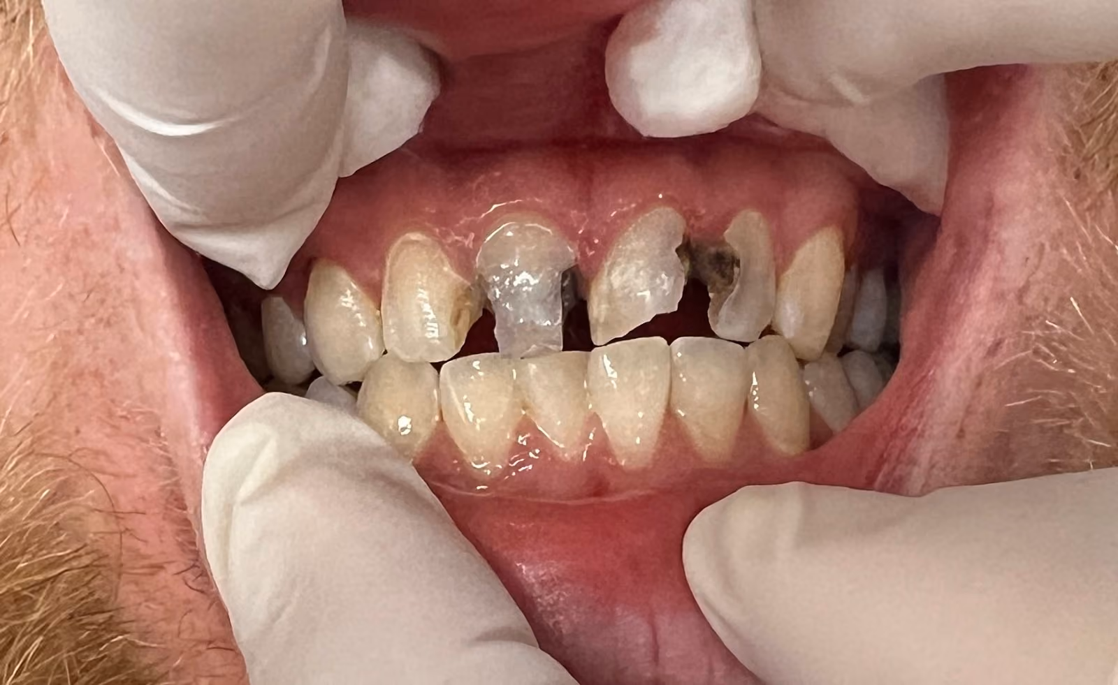 Before Image