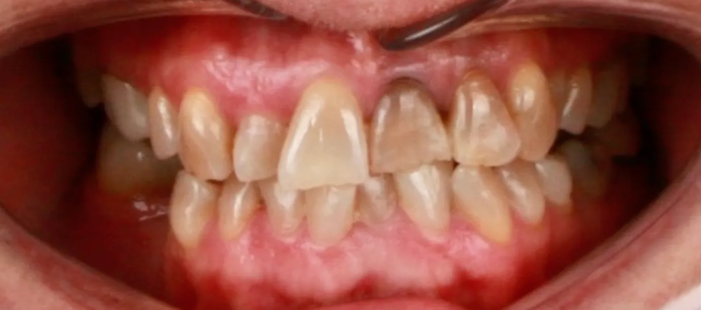 Before Image