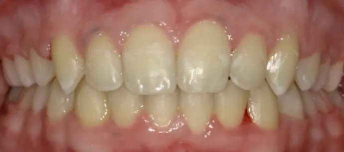 After Image