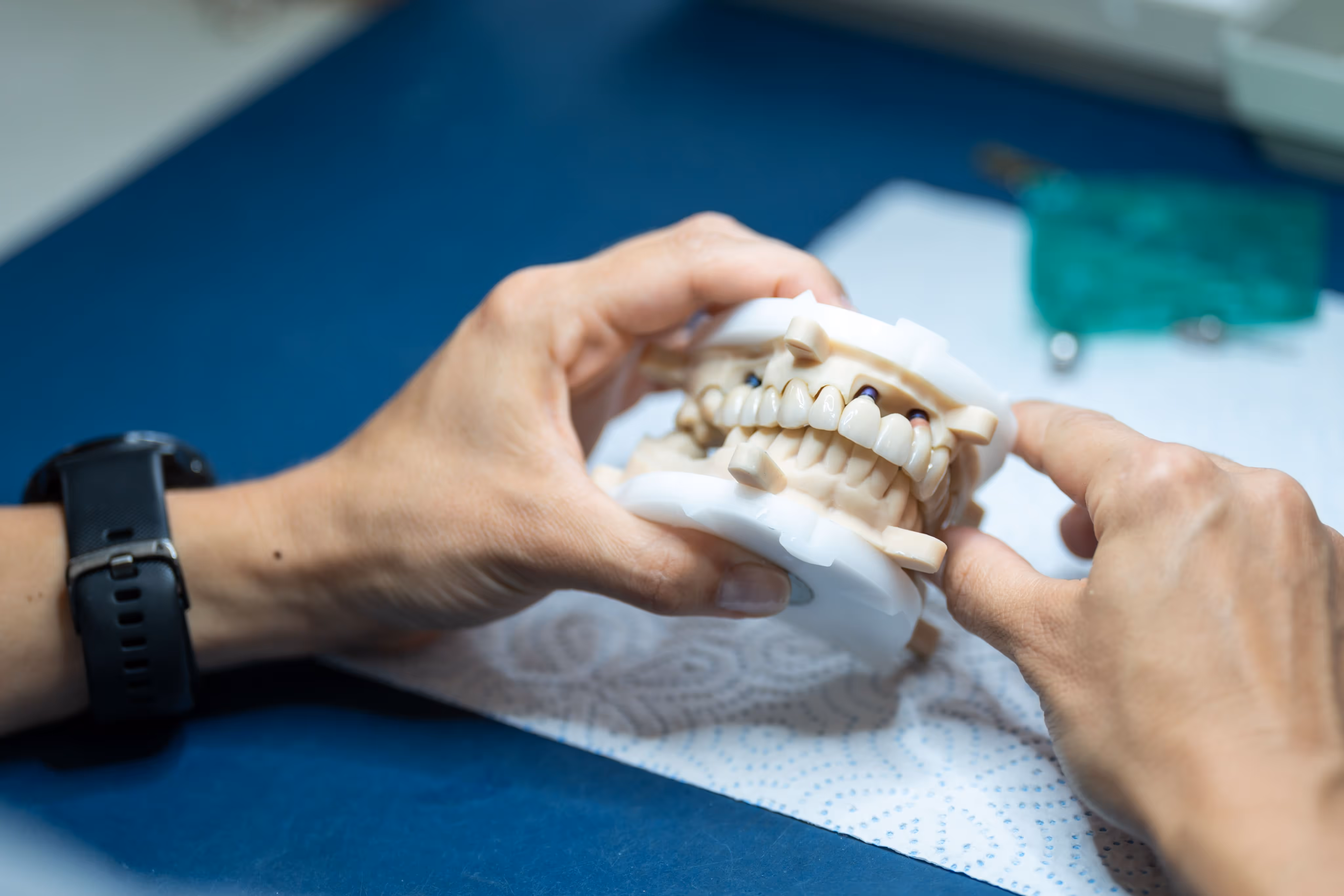 Hands holding a dental model with artificial teeth on a blue surface.