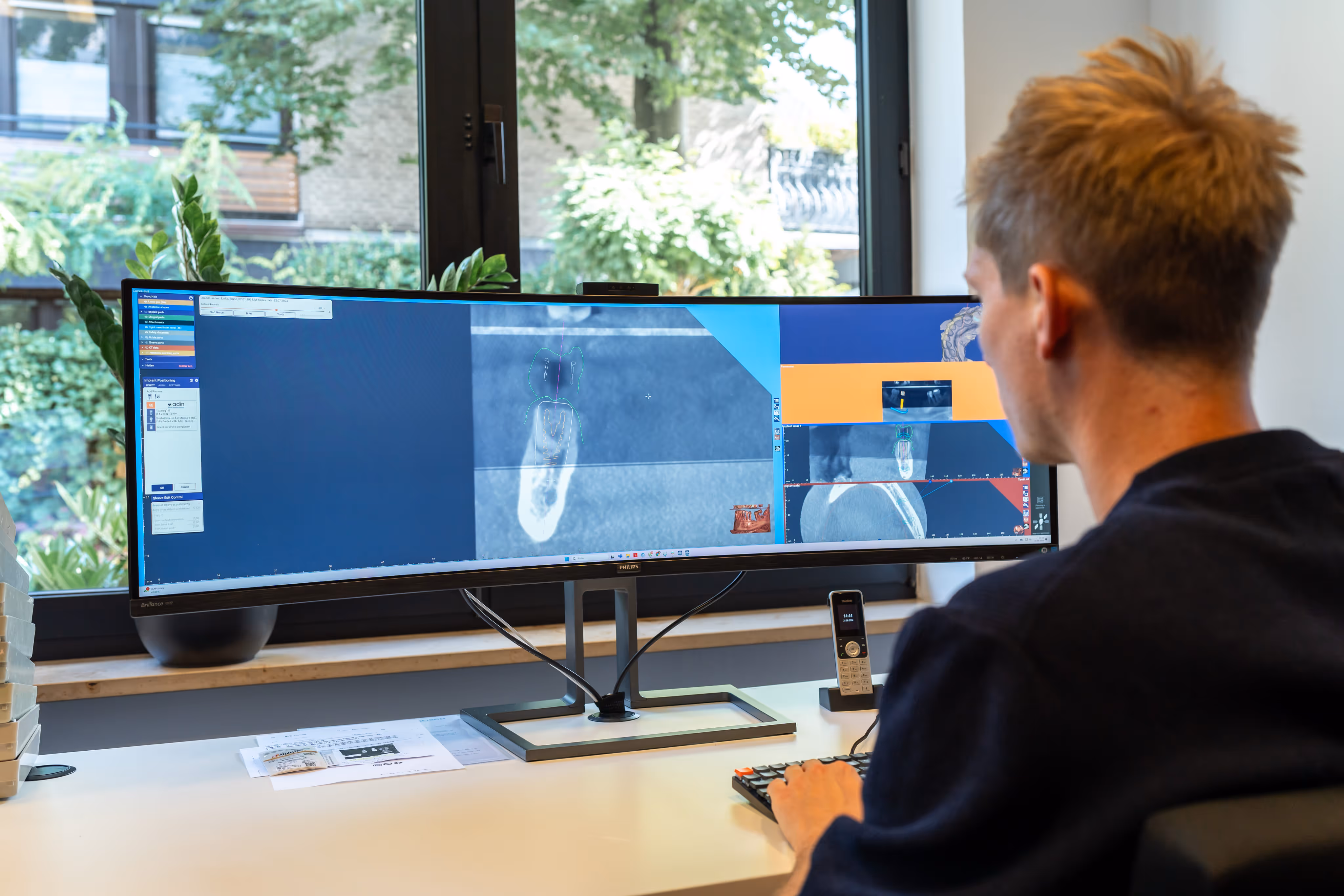 Person analyzing dental X-ray images on an ultra-wide computer monitor in a bright office.