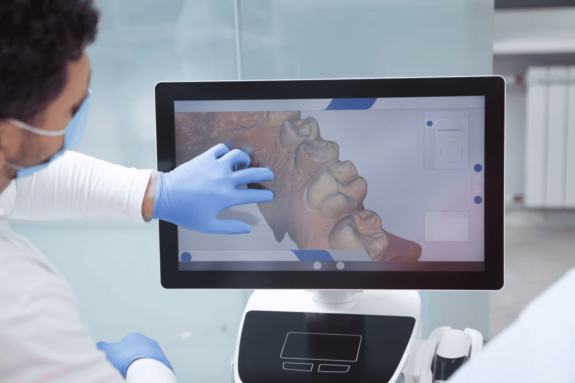 Dentist wearing blue gloves and a mask interacting with a 3D digital model of teeth on a computer screen.