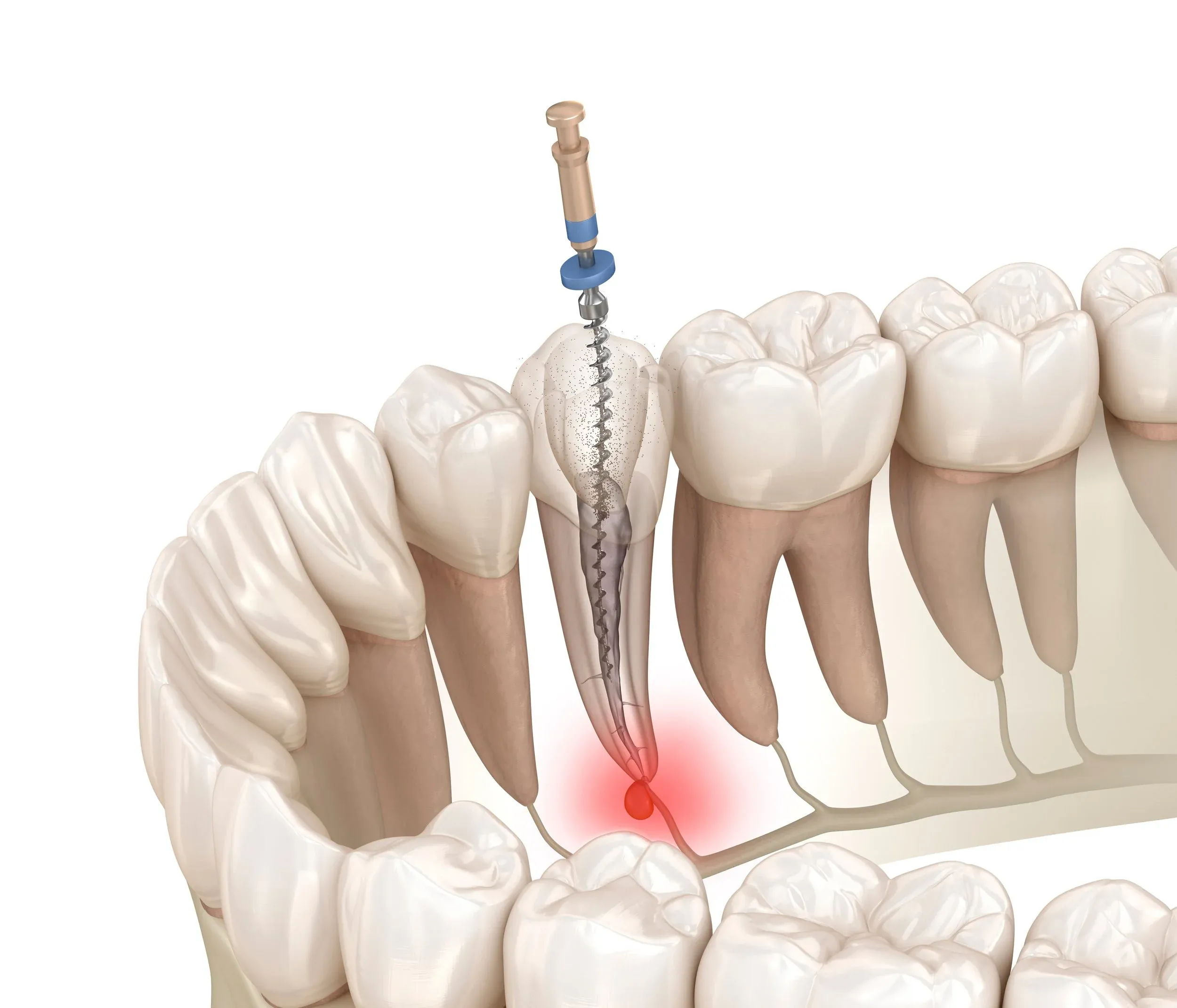 endodontiya