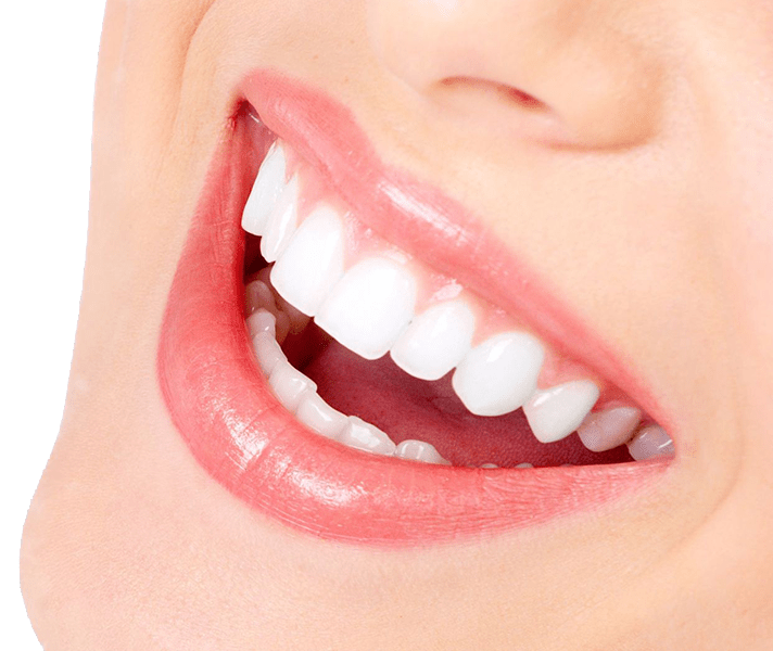 Полірування зубів у Києві