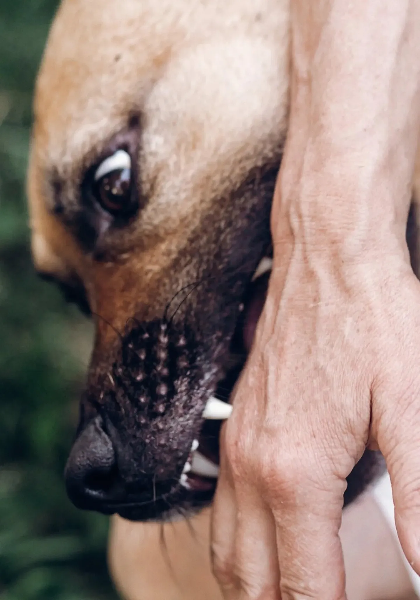 Dog Bites