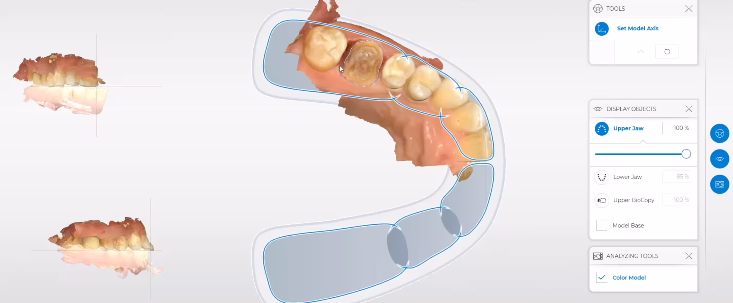 cerec software image - https://www.zahnarztdubendorf.ch/leistungen/cerec