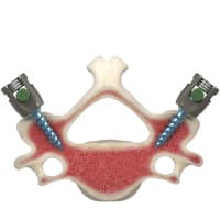 3D Medical Images and Graphics: How Static Visuals Improve Presentation Impact by 60% and Reduce Production Costs by 75%