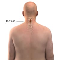 Mechanism of Action Animation: How 3D MOA Videos Increase FDA Approval Rates by 40%