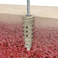 CAD Files to Clinical Clarity: How We Transform Engineering Data Into Trade Show-Ready Animations