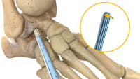 Surgical Procedure Animation: How 3D Medical Videos Reduce Training Time by 60% and Improve Surgeon Confidence