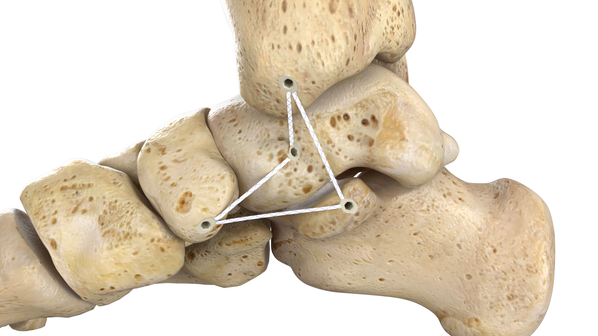 A helpful resource for medical device companies preparing to commission their first animation, including required materials, timelines, and budget considerations.