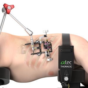 Why I Started Pulse 3D Media: 25 Years of 3D Experience Meets Medical Device Innovation