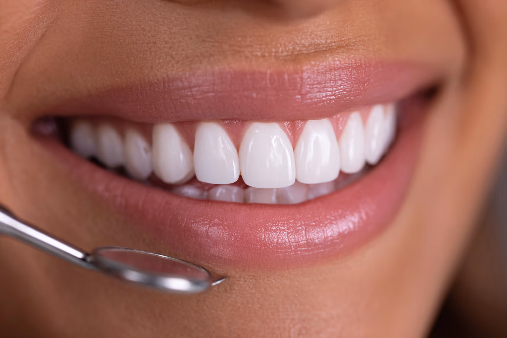 dental-bonding-channahon-il