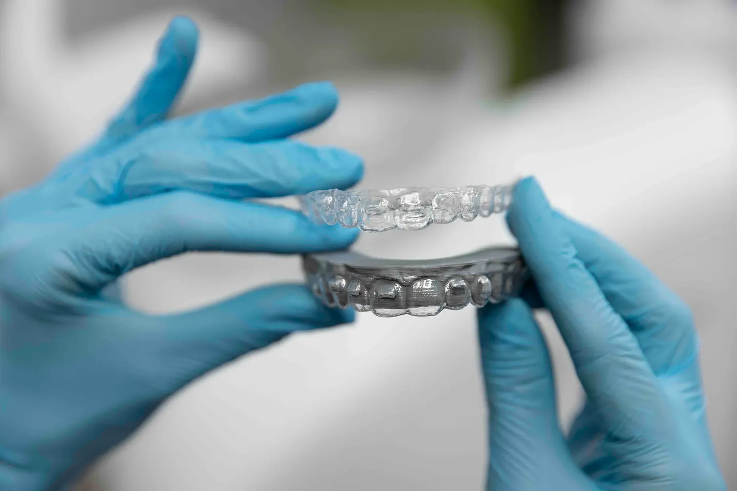 Do Clear Aligners Straighten Teeth? | Charlotte Orthodontist