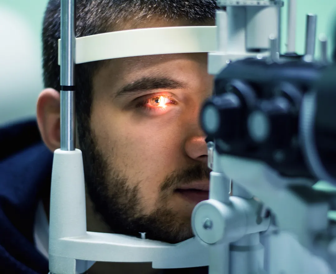 Glaucoma