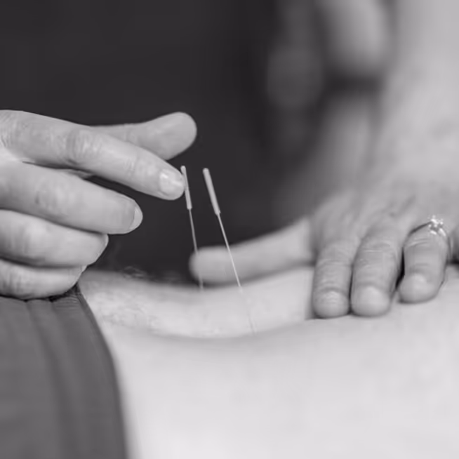 Dry needling die word gedaan bij een patient door sportverzorger Noah Van Holderbeke