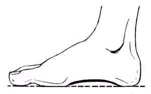 Amount of Pronation