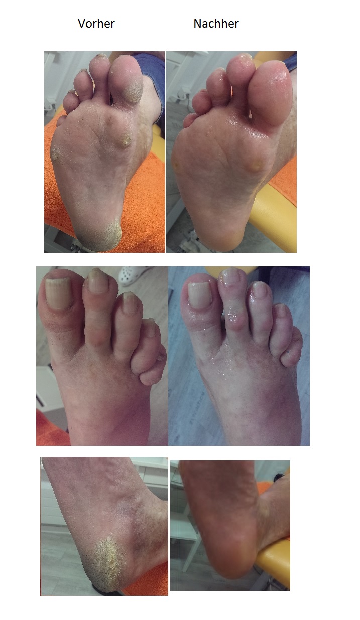 Befoe and after Treatment Images