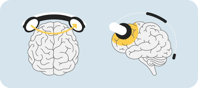 Illustration som visar hjärnan med en tDCS apparat.