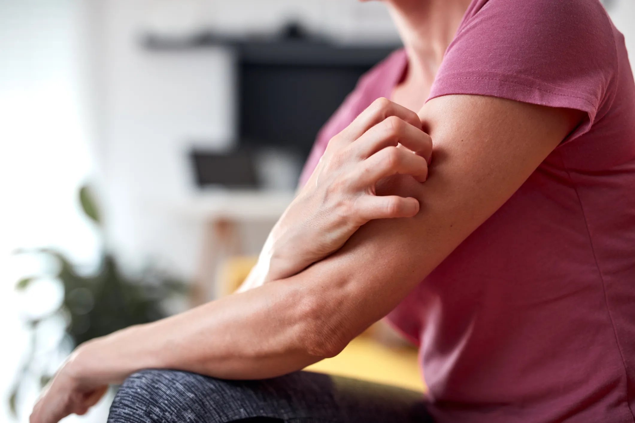 Triamcinolone: A Guide to Treating Eczema, Rashes, and More