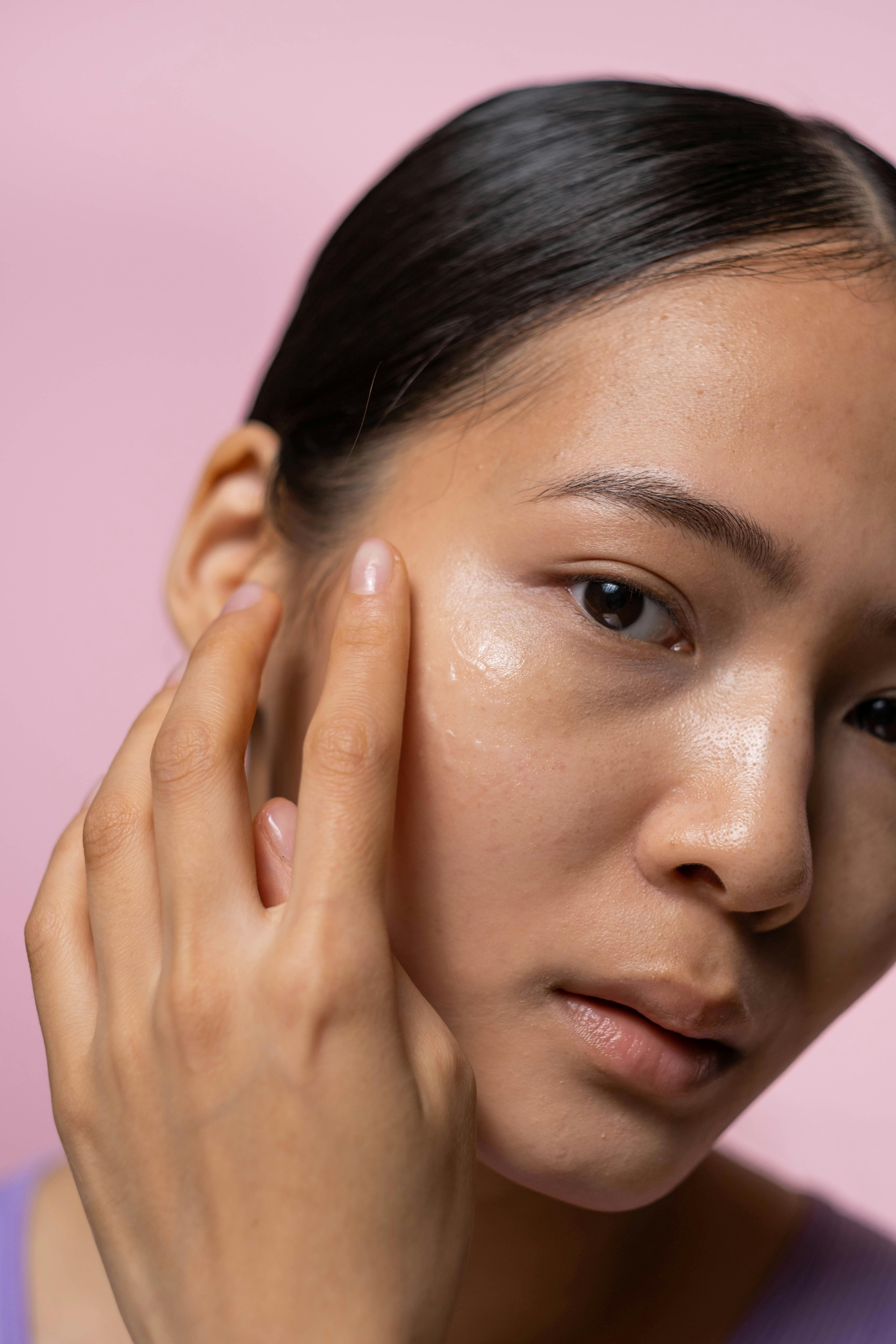 Does Dry Skin Cause Acne? The Surprising Connection
