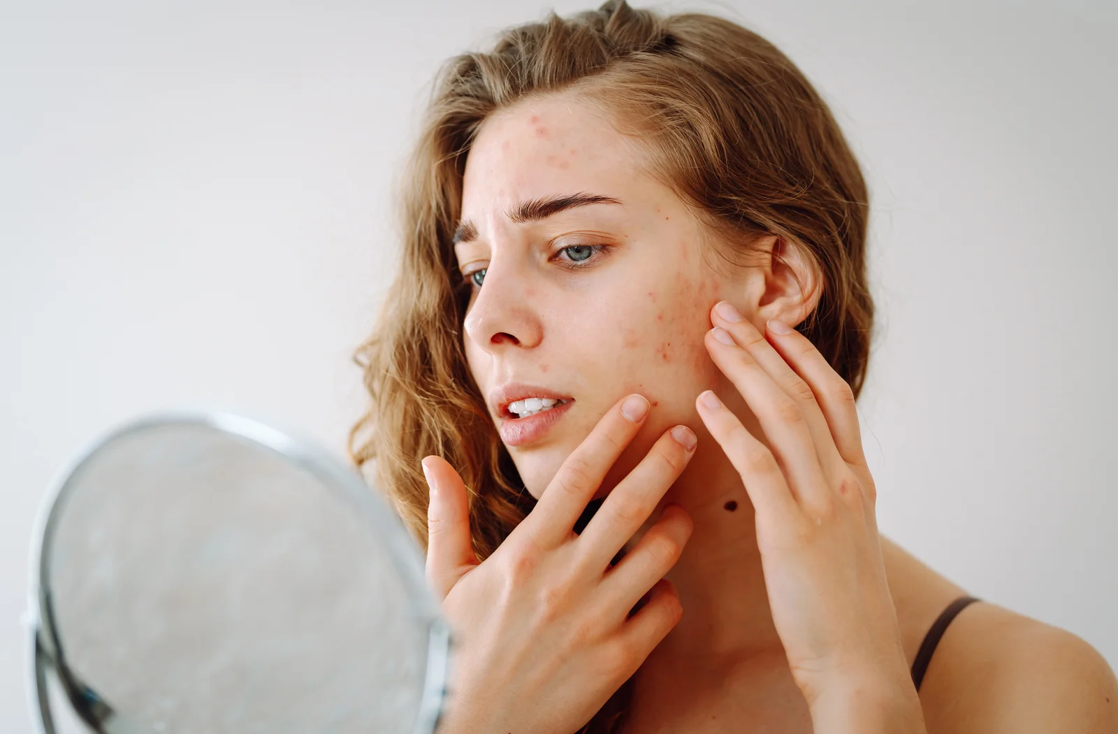 Does LED Light Therapy Really Work for Acne? A Review Found 92% Partial Remission