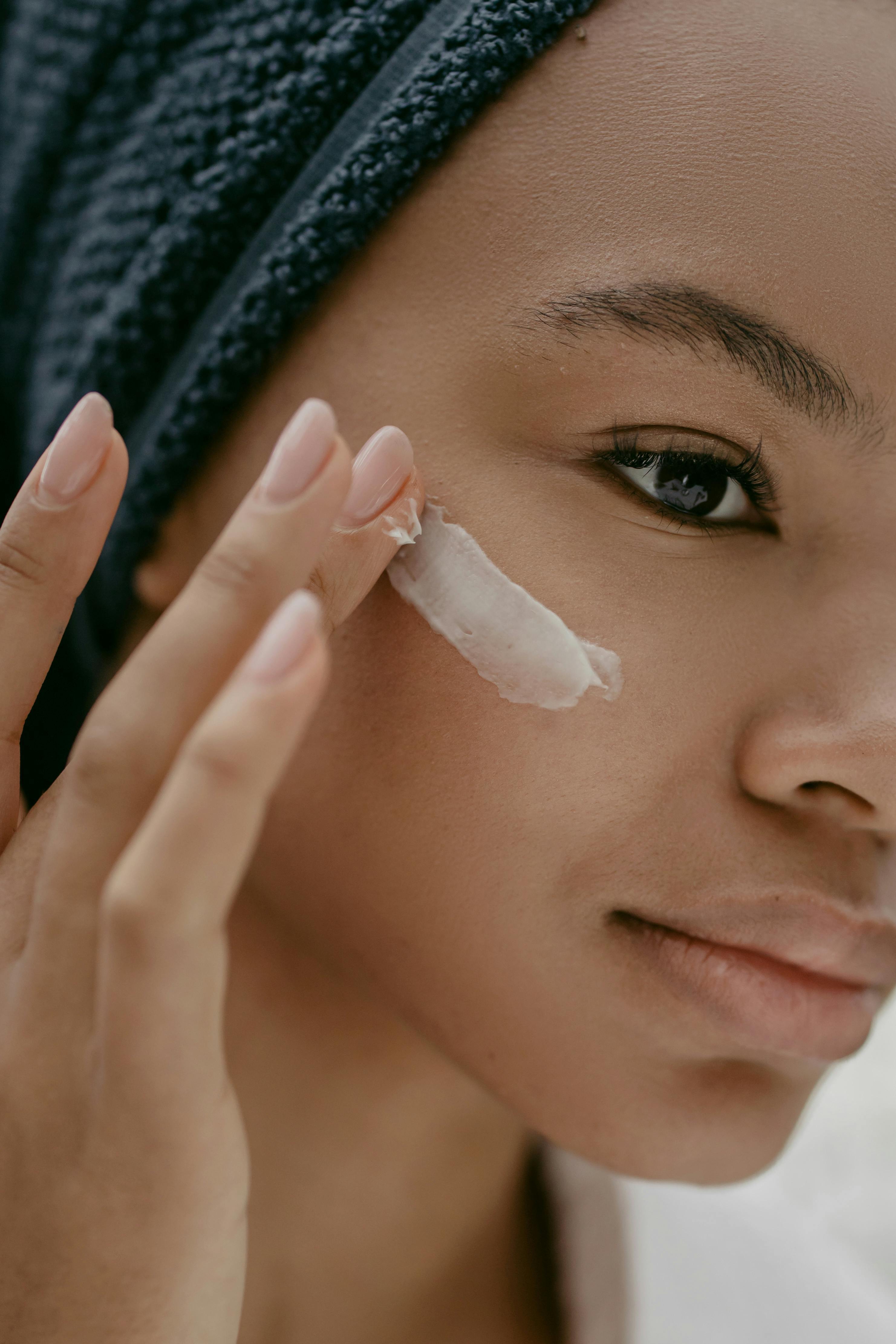 ‘Accutane cream’ is the new topical option patients are asking for