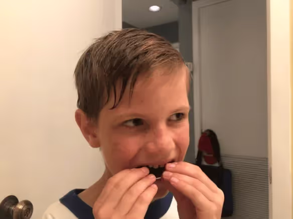 a little boy putting on clear aligners