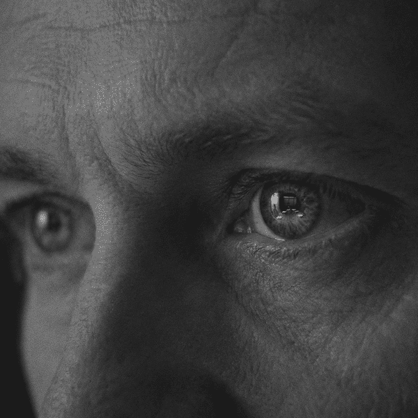 Close-up of a person's eyes and facial skin, showing detailed texture and reflections in the eyes.