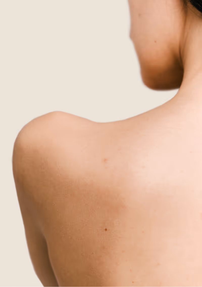 Vue arrière d'une épaule et du cou d'une personne avec une peau claire sur fond beige.