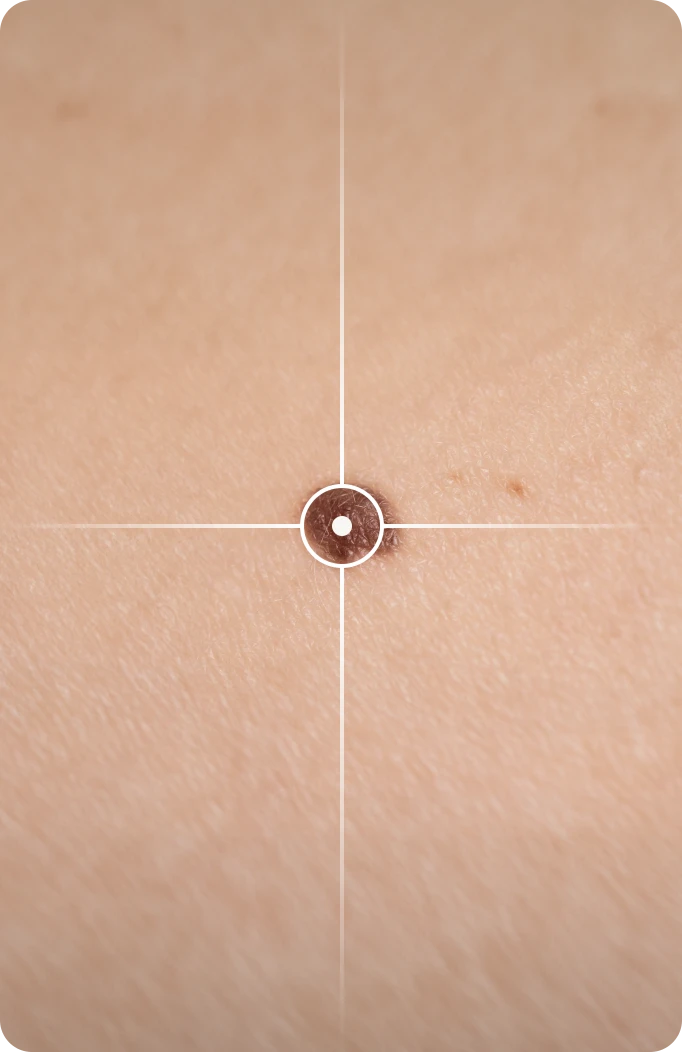 gros plan sur un grain de beauté