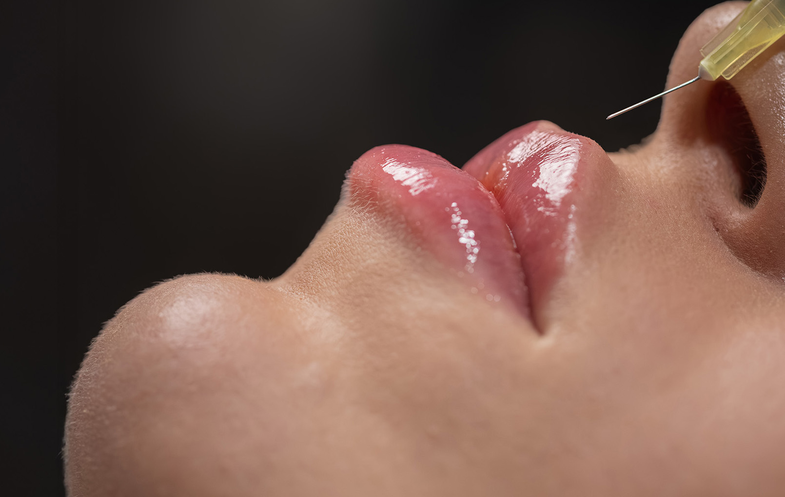 Zbliżenie na błyszczące, pełne usta i nos osoby z igłą strzykawki przygotowaną do iniekcji.