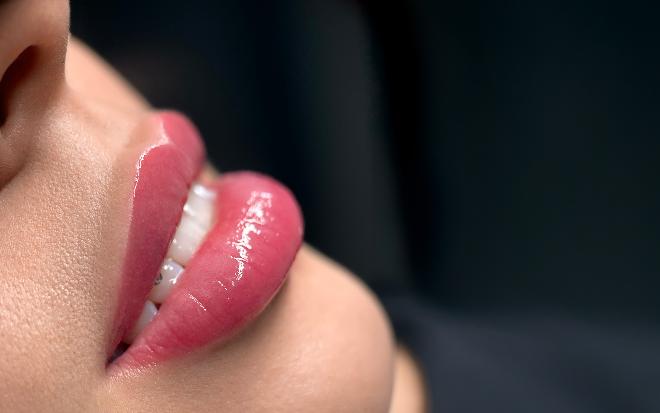 Zbliżenie na usta z połyskującą różową szminką i widoczne białe zęby na ciemnym tle.