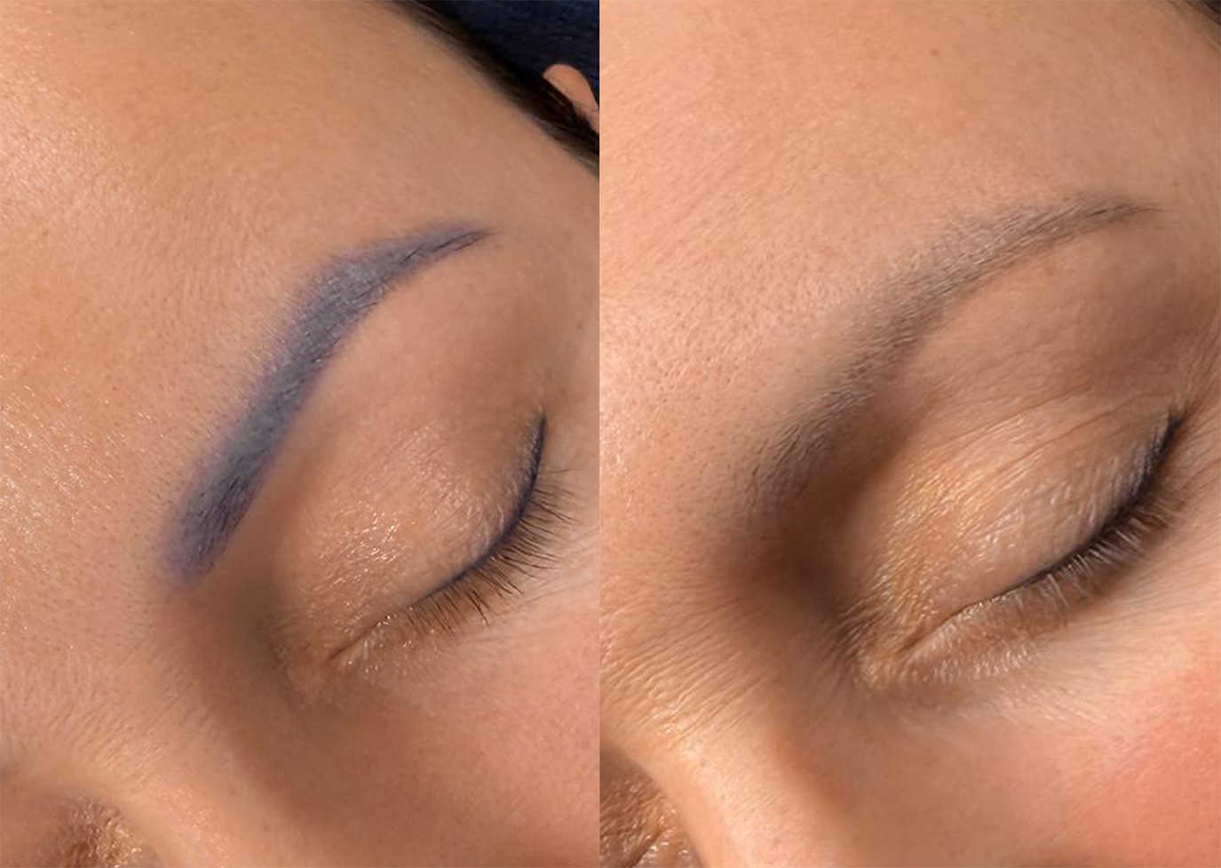 Zdjęcie przedstawiające zbliżenie na zamknięte oko z niebieskim pigmentem na brwi po lewej stronie i naturalnie wyglądającą brwią po prawej stronie.