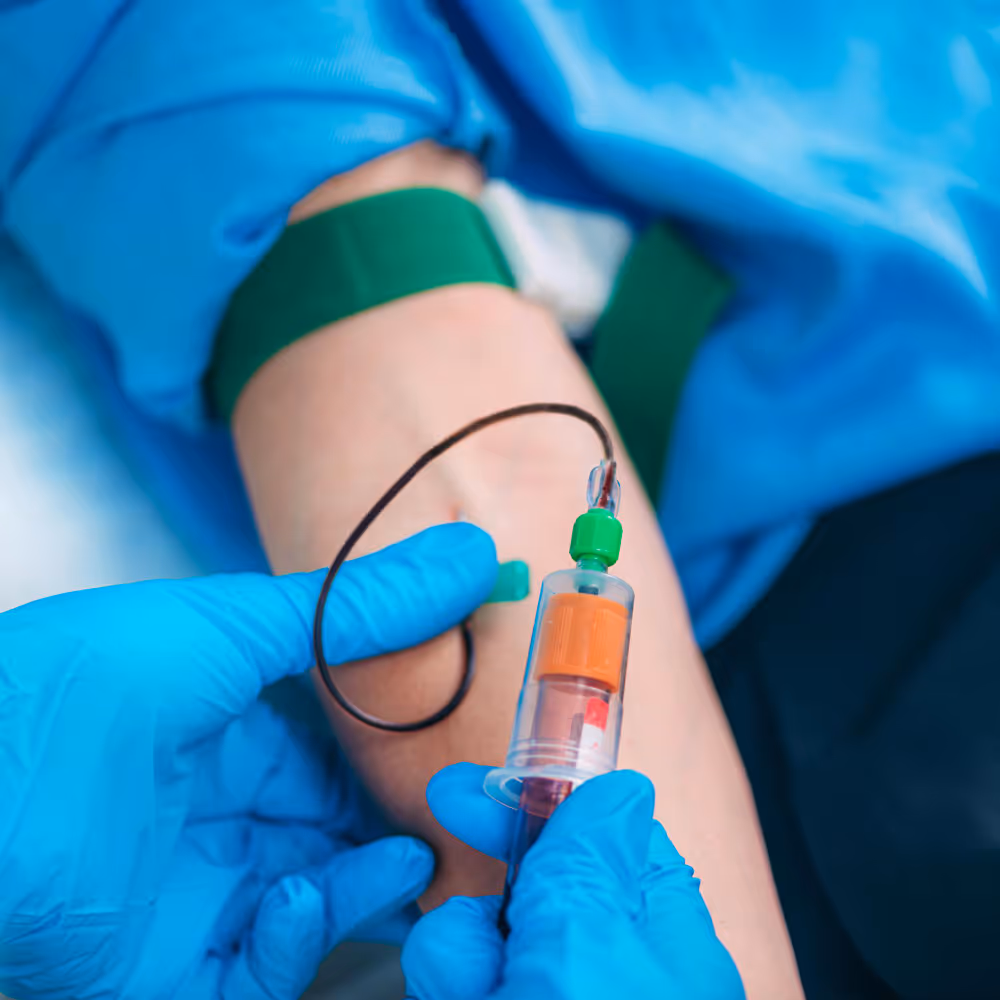 Ręka w rękawiczce medycznej pobierająca krew z ramienia pacjenta z założonym opaskiem uciskowym.