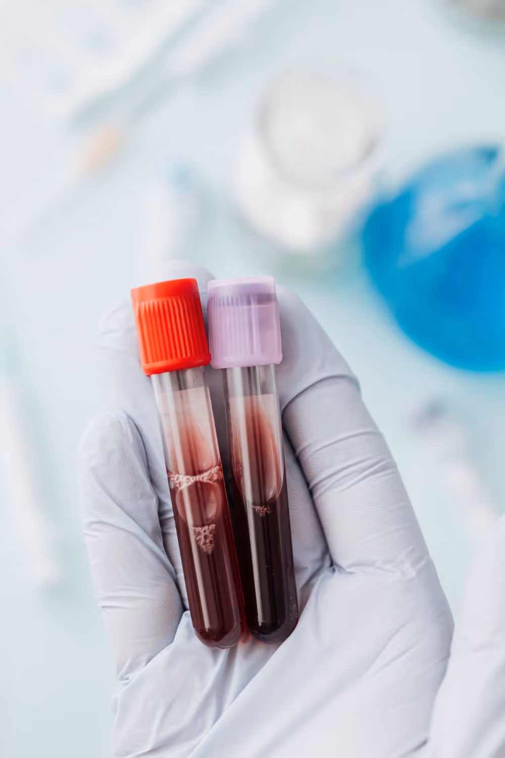 Dłoń w rękawiczce trzymająca dwa probówki z krwią z czerwonym i fioletowym korkiem.