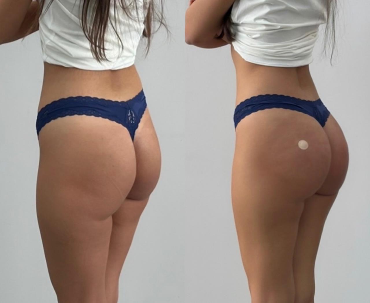 Zdjęcie pokazujące tył kobiety w białej bluzce i ciemnoniebieskich koronkowych majtkach z przodu i z tyłu.