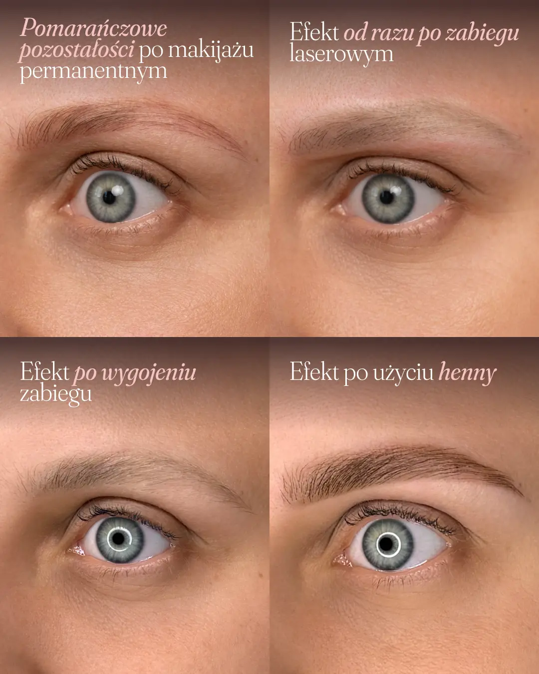 Cztery etapy: pomarańczowe pozostałości po makijażu permanentnym, efekt po zabiegu laserowym, efekt po wygojeniu i brwi po hennie pudrowej — Madame Art Poznań