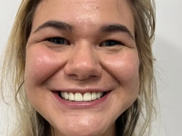 Close-up of a smiling woman with blonde hair and clear skin against a plain white background.