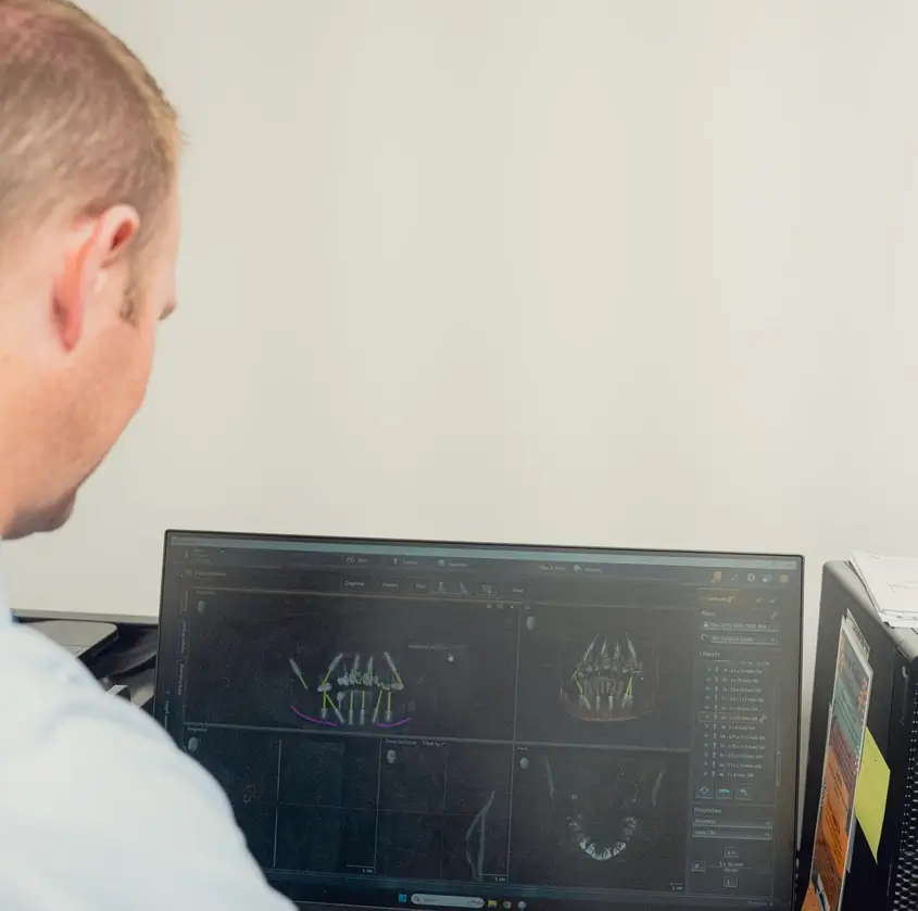 Person reviewing 3D dental X-ray images on a computer monitor in a clinical or dental office setting.