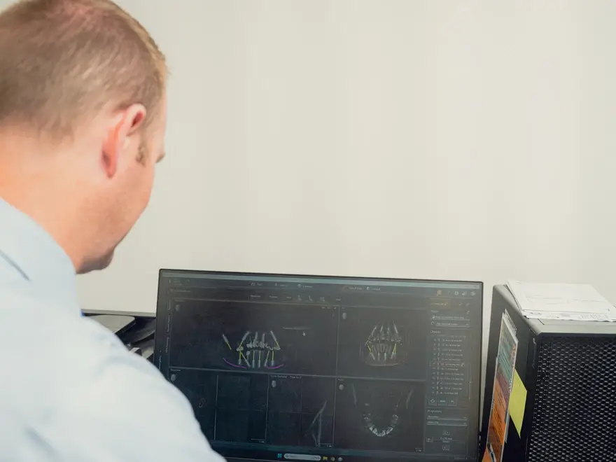 Man looking at a computer screen displaying dental imaging software with 3D views of teeth.